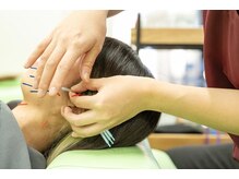 アスミルはり灸接骨院 金山駅前院/美容鍼もあります♪