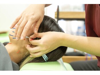 アスミルはり灸接骨院 金山駅前院/美容鍼もあります♪