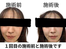 田端整体院/小顔整体/小顔矯正/伊勢崎/