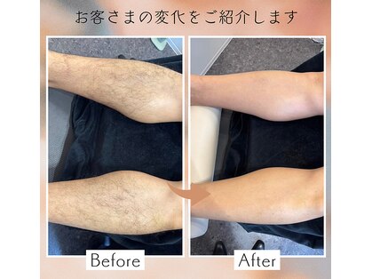 キャル エステティック(Cal esthetic)の写真