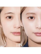 テンディ(TenD.)/【HBL】