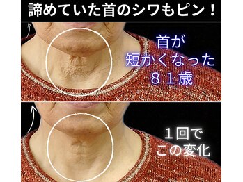 目元 口元のたるみ 眉間シワ改善専門サロン/首のシワハリを改善したい方向け