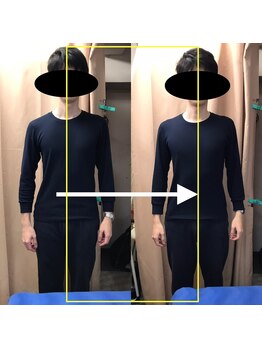 新橋整体グッドラックカイロプラクティック(Good Luck)/微妙な歪みが気になって来院