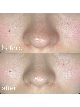 エメリーヌ(AIMELINE)/クリスティーナ ビオフィート