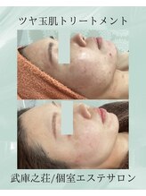 エデン(Eden)/艶肌トリートメント