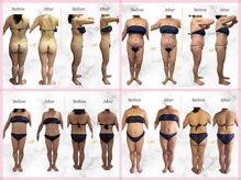 スノーフレイク(SnowFlake)/【お客様Before/After】