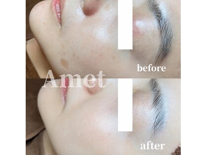 アメット(Amet)の写真