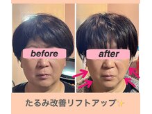 ガーデン(Garden)/フェイシャルエステ施術前後2