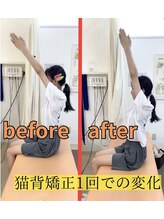 きずな鍼灸整骨院 武蔵ヶ丘本院/猫背矯正