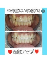 ライトビューティー 本八幡店(LIGHT BEAUTY)/【セルフホワイトニング】