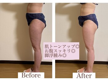 ヨサパーク シュエット(YOSA PARK CHOUETTE)/脚先まで艶肌美しく！