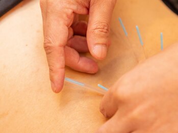 紬はりきゅう接骨院の写真/駅から徒歩3分なので、気軽に通える!鍼灸~マッサージまであなたのお悩みに合わせた施術を行います。