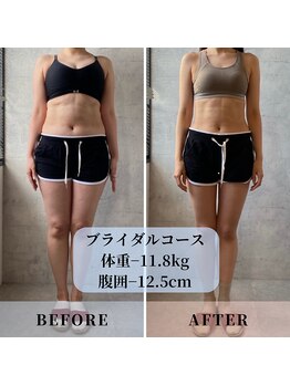 インプルーブ エステティック(Improve ESTHETIC)/