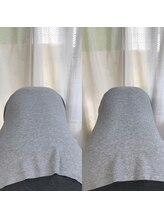 新橋整体グッドラックカイロプラクティック(Good Luck)/骨格矯正コースで骨格から細く