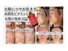 ホワイトアクア 加古川店(WHITE AQUA)/ハーブピーリングで肌荒れ改善