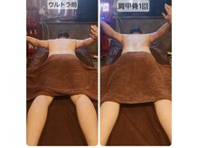 ヴィトワ(Vitowa)/ウルトランスフォーマー施術例8