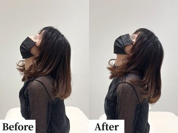 ソレア(Solea)/首痛・巻き肩・肩こり改善1回目