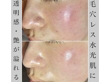 ブラックボックス(BLACK BOX)