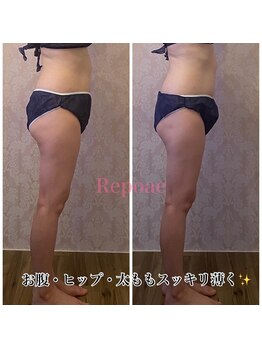 ルポーゼ(Repose)/