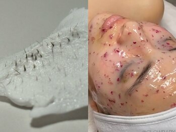 ヴィラ デ ミューズ(Villa des muses)の写真/【フェイシャルWAX+ハイドロジェリーマスク】で、理想のウルツヤ美肌を叶える★お肌の奥からハリツヤUP♪