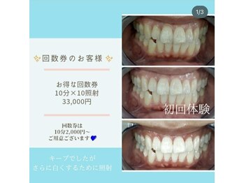 ライトビューティー 本八幡店(LIGHT BEAUTY)/【セルフホワイトニング】