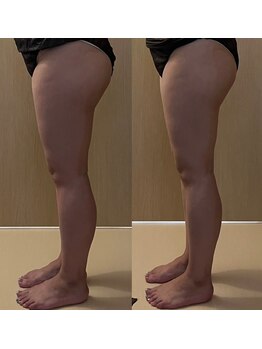 ココア(CoCoa)/セルクラ