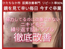 ユウビジン(YOU美人)