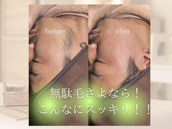 ホワイトワックス つくば店(WHITE WAX)/究極のクレンジング！