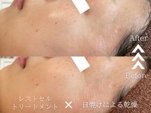 ラヴェリテ(La verite)の雰囲気（リアボーテこだわりの幹細胞ケアで内側からハリのある艶肌が叶う）