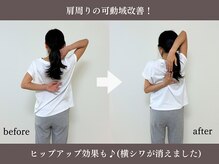 エーアール(AR)