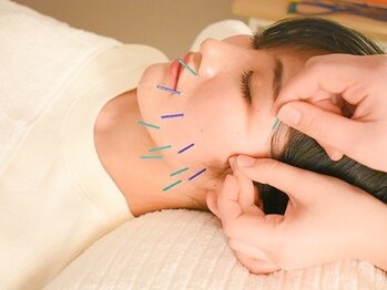 うめきた鍼灸院 センス(SENSE)の写真/美容鍼と全身調律鍼が人気!国家資格所有者による本格施術★オーダーメイドな施術プランをご提案します♪