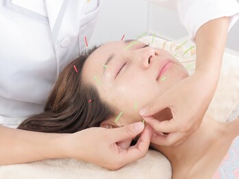 吉祥杏林鍼灸院/リフトアップ効果◎【中板橋】