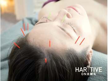 ハリティブ(HARITIVE)の写真/【女性専門◆本気の頭痛改善】痛み止めに頼ってる方必見!!鍼灸で辛い頭痛を根本ケア!首肩こり/眼精疲労も◎