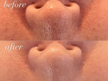 コカオ 銀座サロン(cocao)の写真/人気NO.1★クリスティーナ・ハーブピーリングで毛穴洗浄・韓国風美肌に!貸し切りサロンでゆったりキレイに