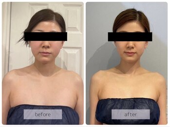 リバース(Rebirth)/綺麗になるお手伝いします♪