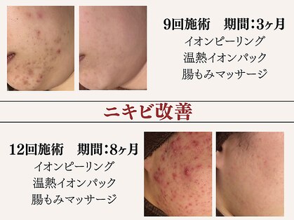 アクール(Accueil)の写真