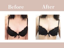 アムール シェリ(Amour Cheri)の雰囲気（育乳プロが育ちづらい原因を徹底解明！バストアップは夢じゃない）