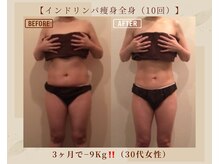オキシー グレイス 黒崎店(OXY Grace)/インドリンパ痩身（全身）