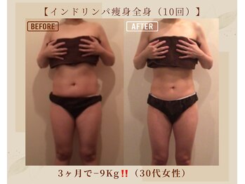 オキシー グレイス 黒崎店(OXY Grace)/インドリンパ痩身（全身）