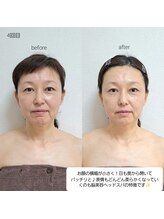 ネマウム(nemaum)/脳美容ドライヘッド