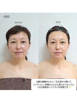 ネマウム(nemaum)/脳美容ドライヘッド