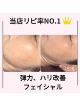 シン(Shin)/【No.1フェイシャル】