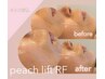 【ピーチリフト初回の方】韓国最新サーマジゆるみ毛穴＆小顔リフト60分