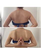 ポラス(Polus)/ポラス式肩甲骨ケア