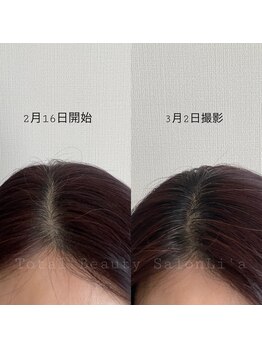 トータルビューティーサロンリア(Li'a)/髪のボリュームや頭皮のお悩みに