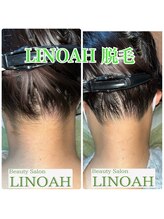 ビューティーサロン リノア(LINOAH)/◎結果重視◎【うなじ脱毛】