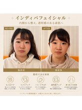 ケイビューティ(k-beauty)/インディバフェイシャル