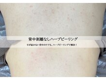 エムラボ 渋谷店(M LABO)/ビフォーアフター