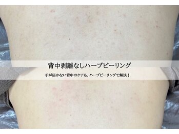 エムラボ 渋谷店(M LABO)/ビフォーアフター