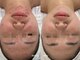 サロンドシー(SALON DE C)の写真